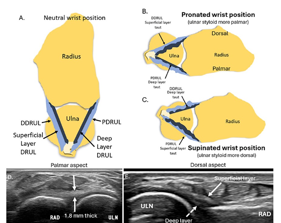 Esquemas en posición neutra, pronación y supinación y ecografías de los ligamentos radiocubitales distales palmar y dorsal