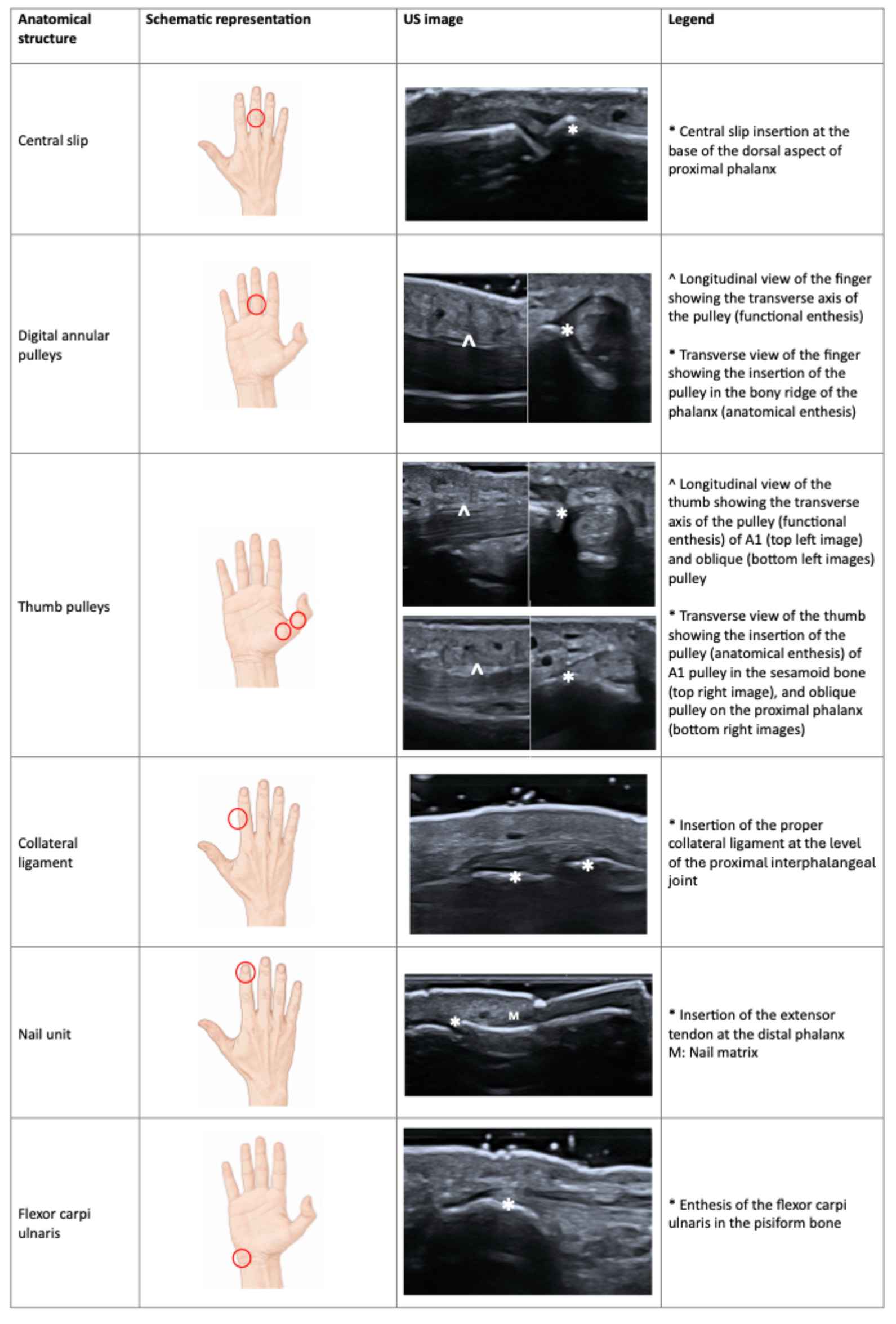 Tabla ilustrada de entesis de mano y muñeca con localización anatómica, esquema e imagen ecográfica