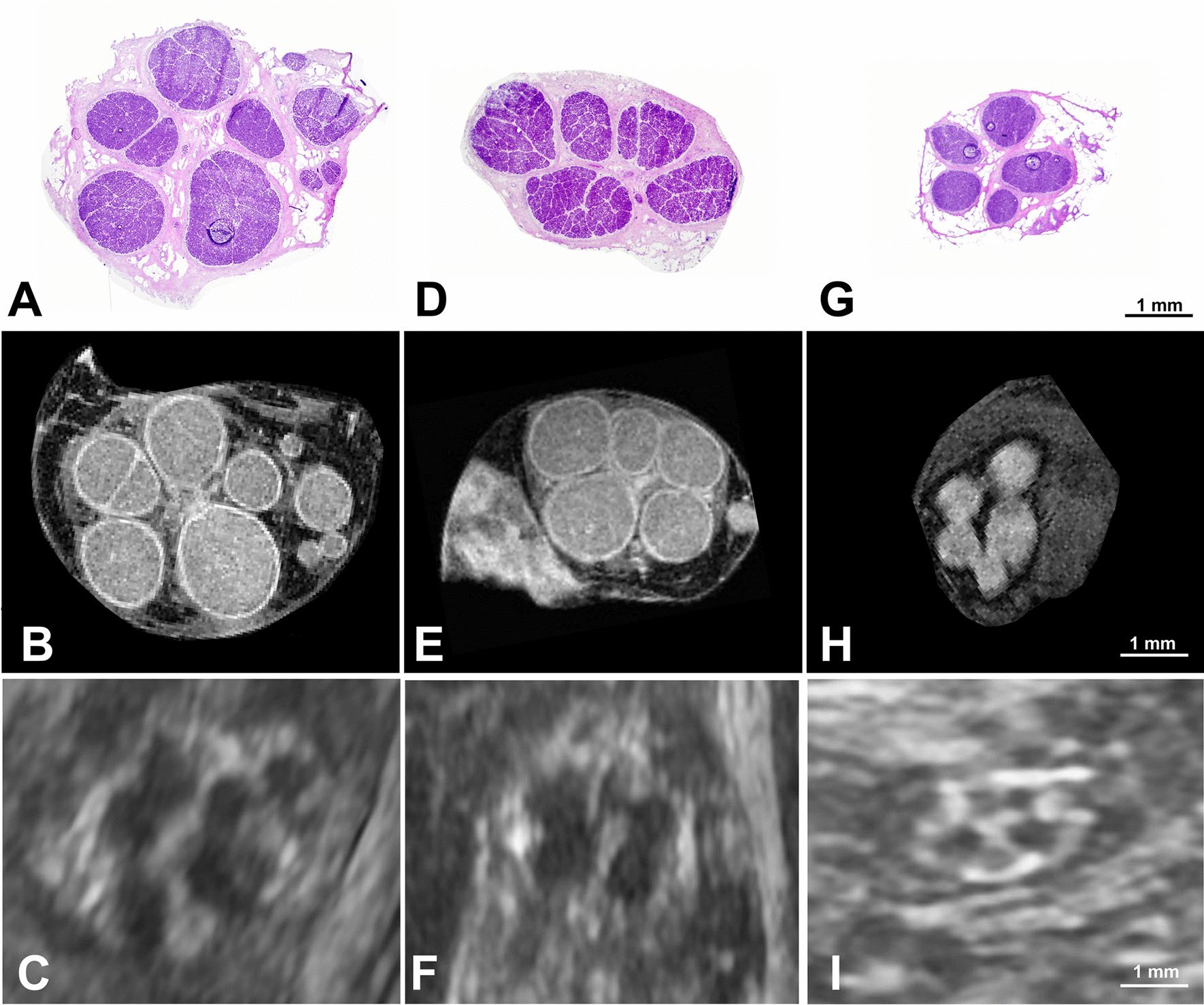 Comparación transversal de nervios mediano, cubital y radial mediante histología, resonancia microscópica y ecografía