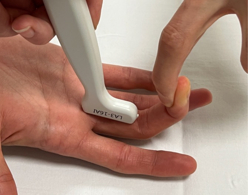Técnica ecográfica de contraflexión del dedo con transductor sobre la falange proximal y resistencia manual